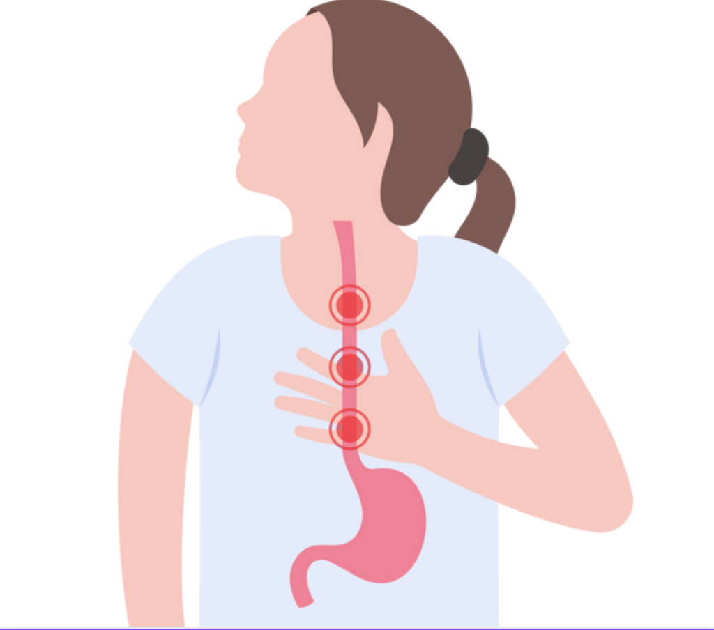 What is menopause and gastric reflux